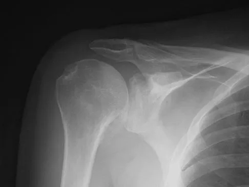 Sports Medicine 2007 Practice Questions: Set 1 (Solved) - Figure 7