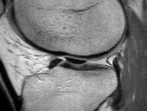 Sports Medicine 2007 Practice Questions: Set 1 (Solved) - Figure 8