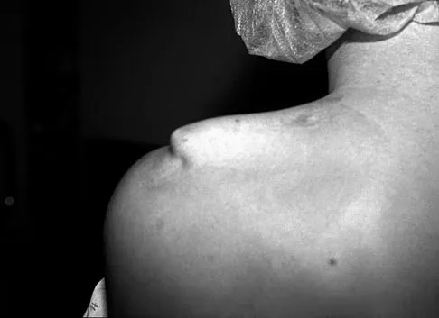 Sports Medicine Board Review 2007: High-Yield MCQs (Set 2) - Figure 13