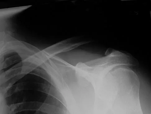 Sports Medicine Board Review 2007: High-Yield MCQs (Set 2) - Figure 14