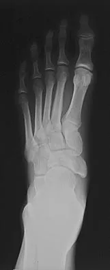 Sports Medicine Board Review 2007: High-Yield MCQs (Set 2) - Figure 7