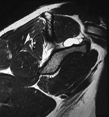 Sports Medicine 2007 Practice Questions: Set 3 (Solved) - Figure 2