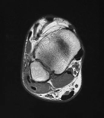 Sports Medicine 2007 Practice Questions: Set 3 (Solved) - Figure 7