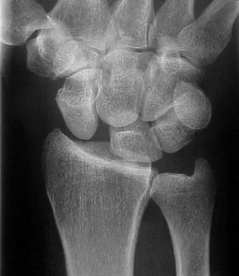 AAOS Sports Medicine MCQs (Set 4): Knee Ligament, Rotator Cuff & Concussion | Board Review