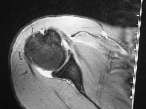 Sports Medicine Board Review 2007: High-Yield MCQs (Set 4) - Figure 11