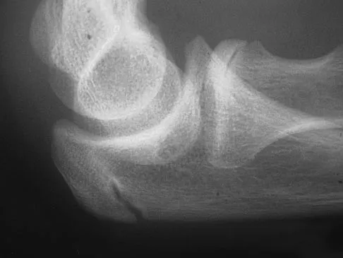 Sports Medicine Board Review 2007: High-Yield MCQs (Set 4) - Figure 3