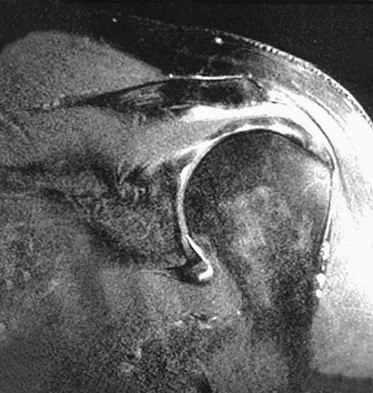 Sports Medicine Board Review 2007: High-Yield MCQs (Set 4) - Figure 7