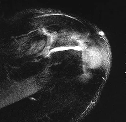 Sports Medicine Board Review 2007: High-Yield MCQs (Set 4) - Figure 8