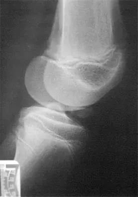 Sports Medicine 2026 MCQs: Board Review Questions & Answers (Part 1) - Figure 77