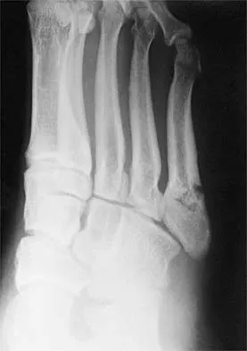 AAOS Sports Medicine MCQs (Part 2): Knee & Shoulder Injuries | 2026 Board Review