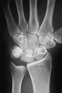 Sports Medicine 2026 MCQs: Board Review Questions & Answers (Part 2) - Figure 23