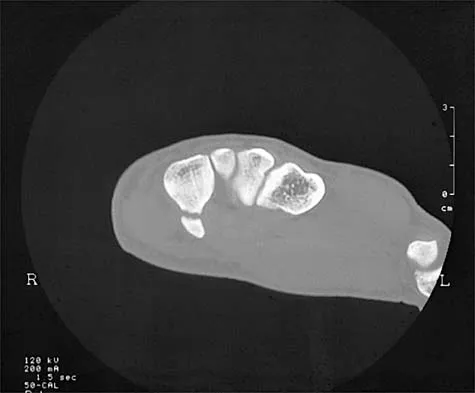 Sports Medicine 2026 MCQs: Board Review Questions & Answers (Part 2) - Figure 3