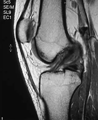 Sports Medicine 2026 MCQs: Board Review Questions & Answers (Part 2) - Figure 31