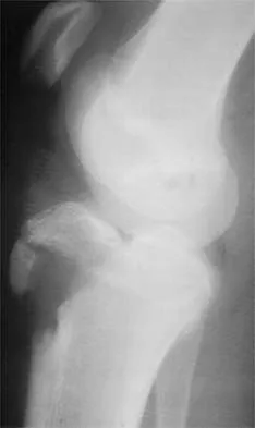 Sports Medicine 2026 MCQs: Board Review Questions & Answers (Part 2) - Figure 43