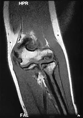 Sports Medicine 2026 MCQs: Board Review Questions & Answers (Part 2) - Figure 57