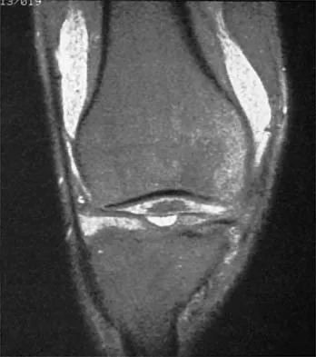 Sports Medicine 2026 MCQs: Board Review Questions & Answers (Part 2) - Figure 59