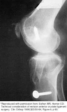 Sports Medicine 2026 MCQs: Board Review Questions & Answers (Part 2) - Figure 79