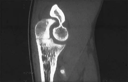 Sports Medicine 2026 MCQs: Board Review Questions & Answers (Part 2) - Figure 83