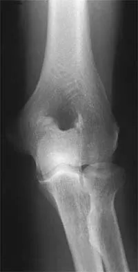 Sports Medicine 2026 MCQs: Board Review Questions & Answers (Part 2) - Figure 91