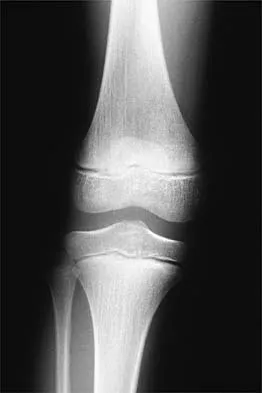 Orthopedic Sports Medicine 2026 MCQs: Knee & Shoulder Injuries (Part 3) | Board Review