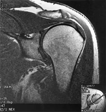 Sports Medicine 2026 MCQs: Board Review Questions & Answers (Part 3) - Figure 17