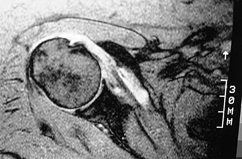 Sports Medicine 2026 MCQs: Board Review Questions & Answers (Part 3) - Figure 33