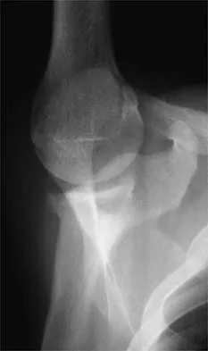 Sports Medicine 2026 MCQs: Board Review Questions & Answers (Part 4) - Figure 13