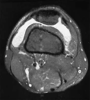 Sports Medicine 2026 MCQs: Board Review Questions & Answers (Part 4) - Figure 17