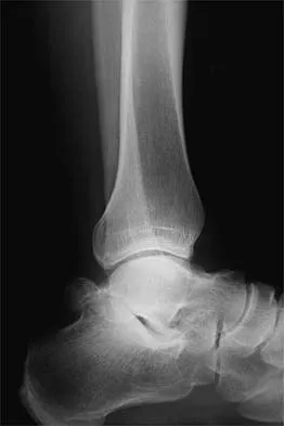 Sports Medicine 2026 MCQs: Board Review Questions & Answers (Part 4) - Figure 29