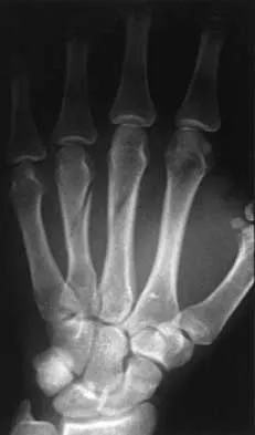 Trauma 2000 Practice Questions: Set 1 (Solved) - Figure 20