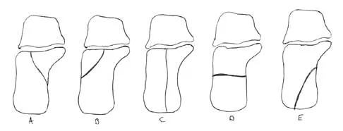 Trauma 2000 Practice Questions: Set 1 (Solved) - Figure 22