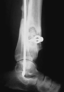 Trauma 2000 Practice Questions: Set 1 (Solved) - Figure 25