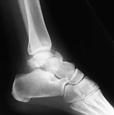 Trauma 2000 Practice Questions: Set 1 (Solved) - Figure 6