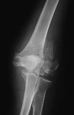 Trauma Board Review 2000: High-Yield MCQs (Set 2) - Figure 18