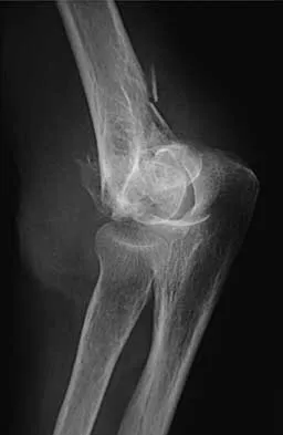 Trauma Board Review 2000: High-Yield MCQs (Set 2) - Figure 19