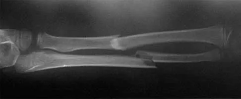 Trauma Board Review 2000: High-Yield MCQs (Set 2) - Figure 22