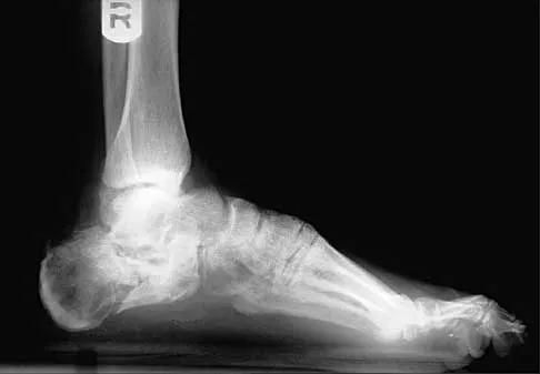 Trauma Board Review 2000: High-Yield MCQs (Set 2) - Figure 24