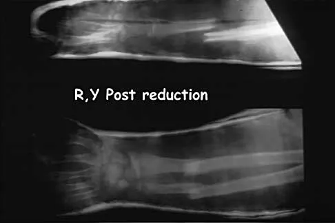Trauma Board Review 2000: High-Yield MCQs (Set 2) - Figure 4