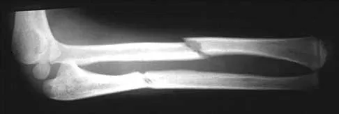 Trauma Board Review 2000: High-Yield MCQs (Set 2) - Figure 7