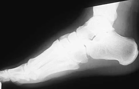 Trauma 2000 Practice Questions: Set 3 (Solved) - Figure 15