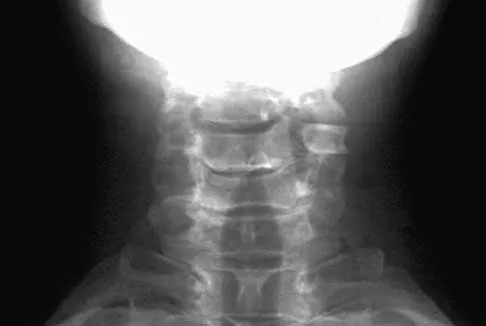 Trauma 2000 Practice Questions: Set 3 (Solved) - Figure 17
