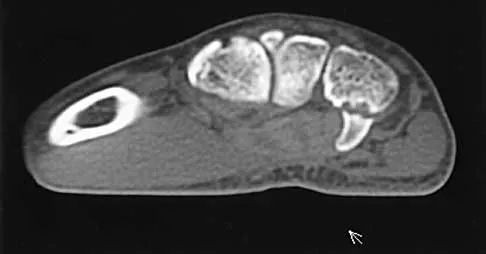 Trauma 2000 Practice Questions: Set 3 (Solved) - Figure 21