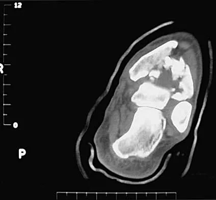 Trauma 2000 Practice Questions: Set 3 (Solved) - Figure 7