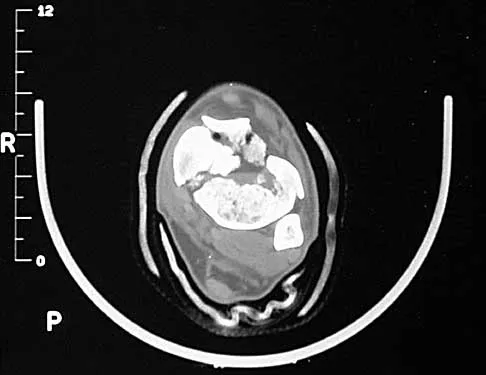 Trauma 2000 Practice Questions: Set 3 (Solved) - Figure 8