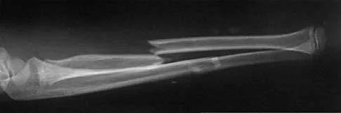 Trauma Board Review 2000: High-Yield MCQs (Set 4) - Figure 11