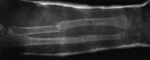 Trauma Board Review 2000: High-Yield MCQs (Set 4) - Figure 12