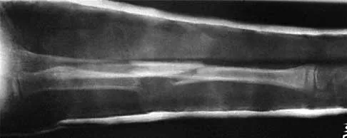 Trauma Board Review 2000: High-Yield MCQs (Set 4) - Figure 13