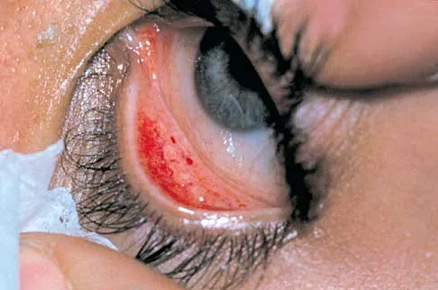 Trauma Board Review 2000: High-Yield MCQs (Set 4) - Figure 14