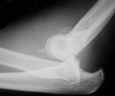 Trauma Board Review 2000: High-Yield MCQs (Set 4) - Figure 17