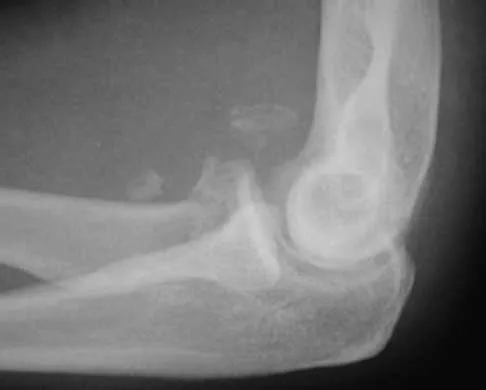 Trauma Board Review 2000: High-Yield MCQs (Set 4) - Figure 19